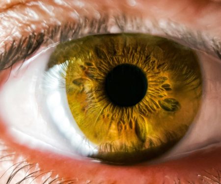 Iridology